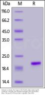 Human IL-1 beta / IL-1F2 Protein, His Tag (MALS verified)