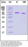 Human IL-23 alpha & IL-12 beta Heterodimer Protein, premium grade
