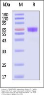 Human IL-7 R alpha&TSLP R Heterodimer Protein, Fc Tag&Fc Tag