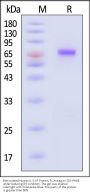 Biotinylated Human IL-21 R Protein, Fc,Avitag™ (MALS verified)