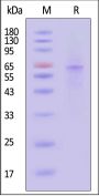 Human IRAK4 Protein, His Tag