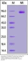 Cynomolgus Integrin isoform alpha-7X1B beta 1 (ITGA7X1B&ITGB1) Heterodimer Protein, Tag Free&His Tag (MALS verified)