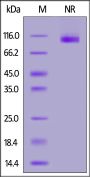 Cynomolgus Integrin isoform alpha-7X1B beta 1 (ITGA7X1B&ITGB1) Heterodimer Protein, Tag Free&His Tag (MALS verified)