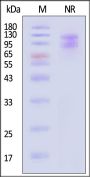 Cynomolgus Integrin alpha V beta 1 (ITGAV&ITGB1) Heterodimer Protein, His Tag&Tag Free