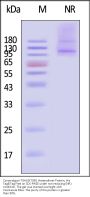 Cynomolgus Integrin alpha 11 beta 1 (ITGA1&ITGB1) Heterodimer Protein, His Tag&Tag Free