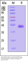 Human ITPRIPL1 Protein, Fc Tag (MALS verified)