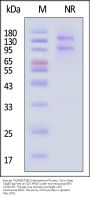 Human Integrin alpha 8 beta 1 (ITGA8&ITGB1) Heterodimer Protein, Twin-Streptavidin Tag&Tag Free