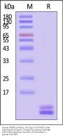Human ITPRIPL1 Protein, His Tag