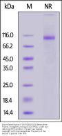 Biotinylated Human Integrin isoform alpha-7X2B beta 1 (ITGA7X2B&ITGB1) Heterodimer Protein, Avitag™&His,Avitag™