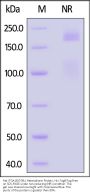 Rat Integrin alpha 1 beta 1 (ITGA1&ITGB1) Heterodimer Protein, His Tag&Tag Free
