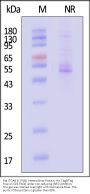 Rat ITGA8 & ITGB1 Heterodimer Protein, His Tag&Tag Free