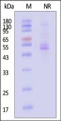 Rat ITGA8 & ITGB1 Heterodimer Protein, His Tag&Tag Free