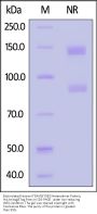 Biotinylated Human Integrin alpha V beta 3 (ITGAV&ITGB3) Heterodimer Protein, His,Avitag™&Tag Free (MALS verified)