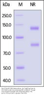 Rat Integrin alpha V beta 3 (ITGAV&ITGB3) Heterodimer Protein, His Tag&Tag Free (MALS verified)