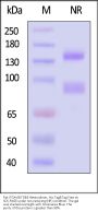 Rat Integrin alpha V beta 5 (ITGAV&ITGB5) Heterodimer Protein, His Tag&Tag Free