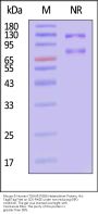 Mouse & Human Integrin alpha V beta 6 (ITGAV&ITGB6) Heterodimer Protein, His Tag&Tag Free (MALS verified)