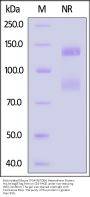 Biotinylated Mouse Integrin alpha V beta 6 (ITGAV&ITGB6) Heterodimer Protein, His,Avitag™&Tag Free (MALS verified)