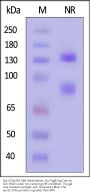 Rat Integrin alpha V beta 6 (ITGAV&ITGB6) Heterodimer Protein, His Tag&Tag Free (MALS verified)