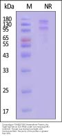 Cynomolgus Integrin alpha E beta 7 (ITGAE&ITGB7) Heterodimer Protein, His Tag&Tag Free