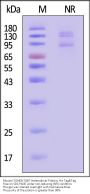 Mouse Integrin alpha E beta 7 (ITGAE&ITGB7) Heterodimer Protein, His Tag&Tag Free