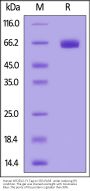 Human KIR2DL2 / CD158b1 / NKAT-6 Protein, Fc Tag