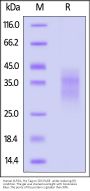 Human KLRG1 Protein, His Tag
