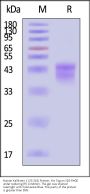 Human Kallikrein 1 / KLK-1 (25-262) Protein, His Tag (Pro-form, HPLC verified)