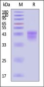 Human Kallikrein 1 / KLK-1 (25-262) Protein, His Tag (Pro-form, HPLC verified)