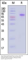 Human Plasma Kallikrein / KLKB1 Protein, His Tag (Pro-form, MALS verified)