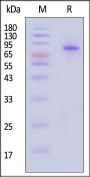 Human Plasma Kallikrein / KLKB1 Protein, His Tag (Pro-form, MALS verified)