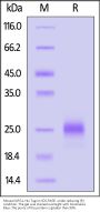 Mouse KLRG1 Protein, His Tag (MALS & SPR verified)