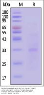 Mouse Plasma Kallikrein / KLKB1 Protein, His Tag