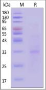 Mouse Plasma Kallikrein / KLKB1 Protein, His Tag