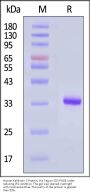 Human Kallikrein 3 Protein, His Tag (Pro-form, MALS verified)