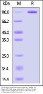 Cynomolgus / Rhesus macaque Klotho beta Protein, His Tag