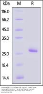 Human KRAS (G12S) Protein, His Tag (HPLC-verified) (active enzyme)