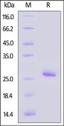 Human KRAS (G12S) Protein, His Tag (HPLC-verified) (active enzyme)