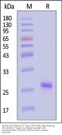 Human KRAS Protein, His Tag (active enzyme, HPLC verified)