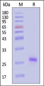 Human KRAS Protein, His Tag (active enzyme, HPLC verified)