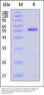 Human LAG-3 / CD223 Protein, His Tag (MALS verified)