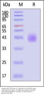 Human LAP (TGF-beta 1) Protein, Tag Free (MALS verified)