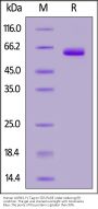 Human LILRB4 / CD85k / ILT3 Protein, Fc Tag (MALS verified)