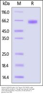 Human LILRA4 / CD85g / ILT7 Protein, His Tag