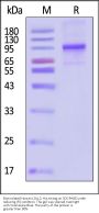 Biotinylated Human LOXL2 Protein, His,Avitag™ (active enzyme)