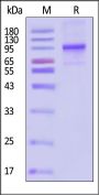 Biotinylated Human LOXL2 Protein, His,Avitag™ (active enzyme)
