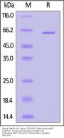 Human MAOA Protein, His Tag (active enzyme)