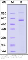 Human MAOB / Monoamine Oxidase B Protein, His Tag (active enzyme)