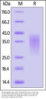 Biotinylated Human MICA (201-309) Protein, His,Avitag™ (MALS verified)