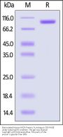 Biotinylated Human MICA Protein, Fc,Avitag™ (MALS verified)