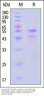 Human MMP-10 Protein, Tag Free (active enzyme)